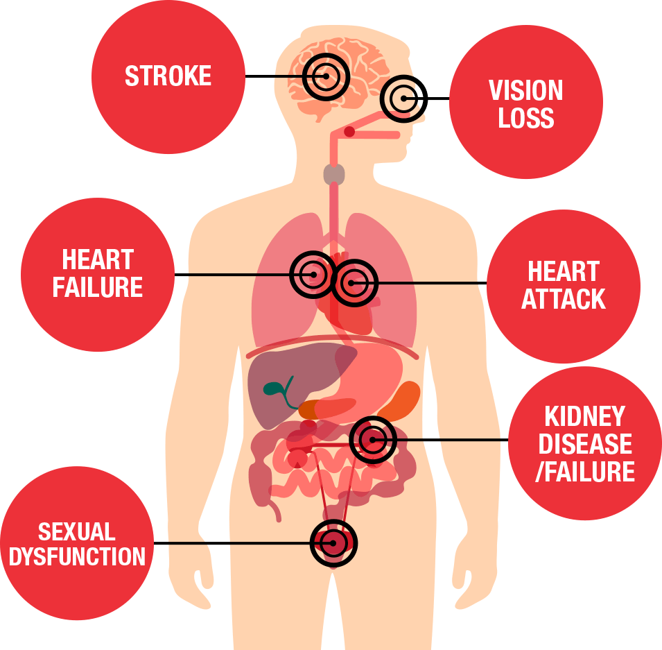 The Blood Pressure Program